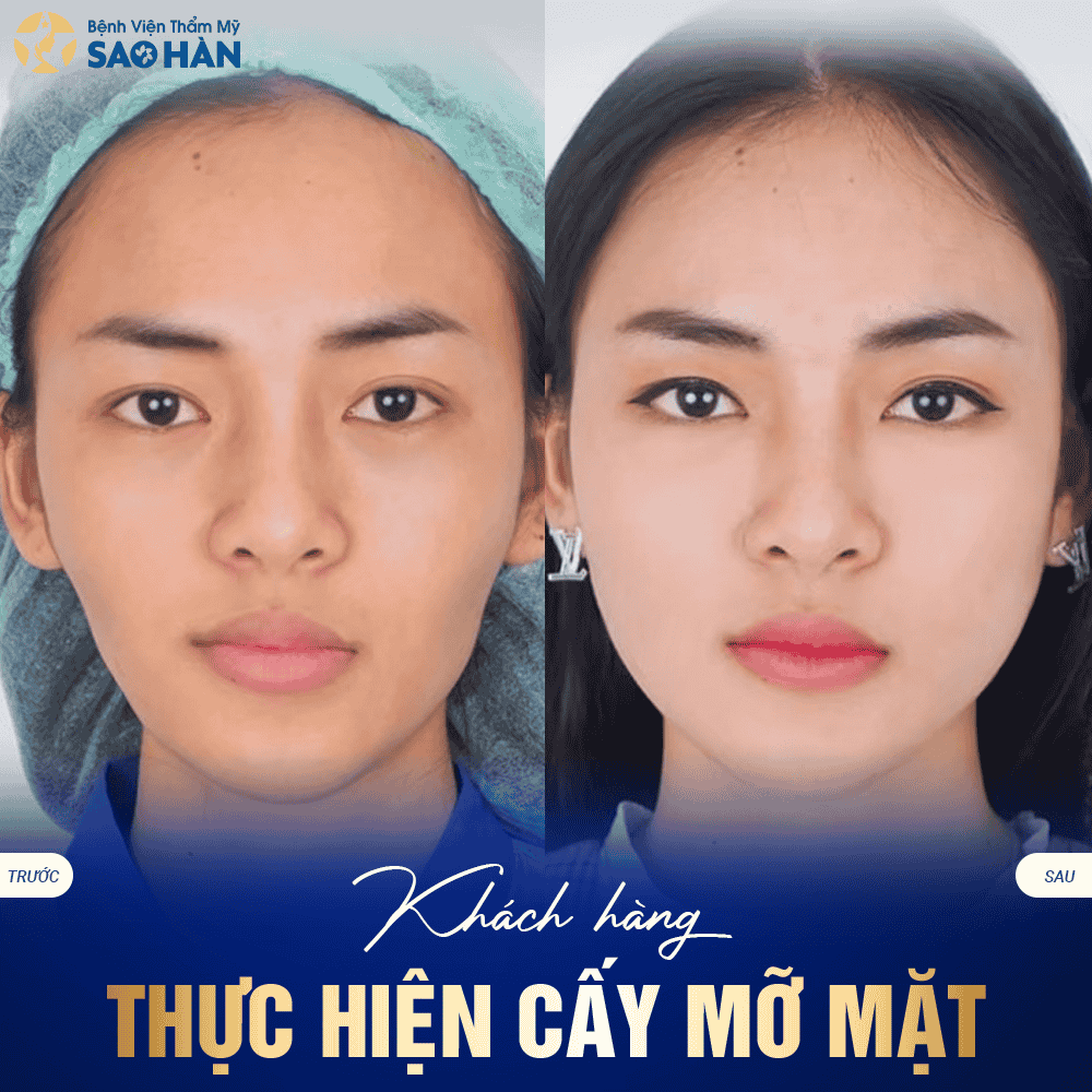Truoc Sau