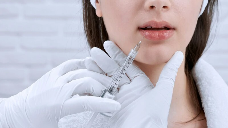 Thời Gian Tối Thiểu Giữa Các Lần Tiêm Filler Tối Thiểu Là Một Năm