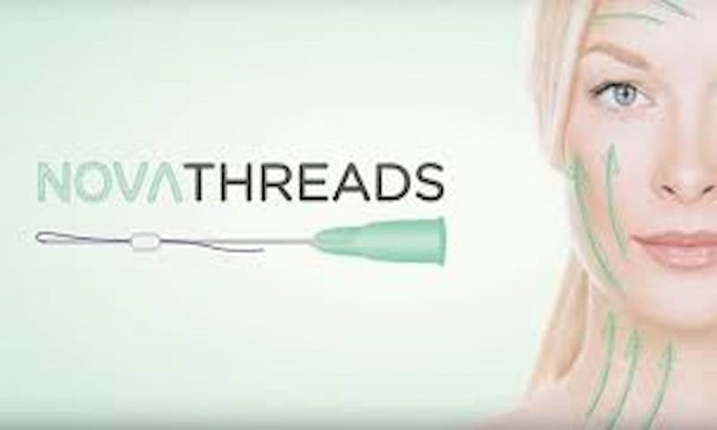 Chỉ Novathreads