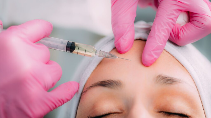 Bị Sưng Sau Tiêm Filler Rất Bình Thường