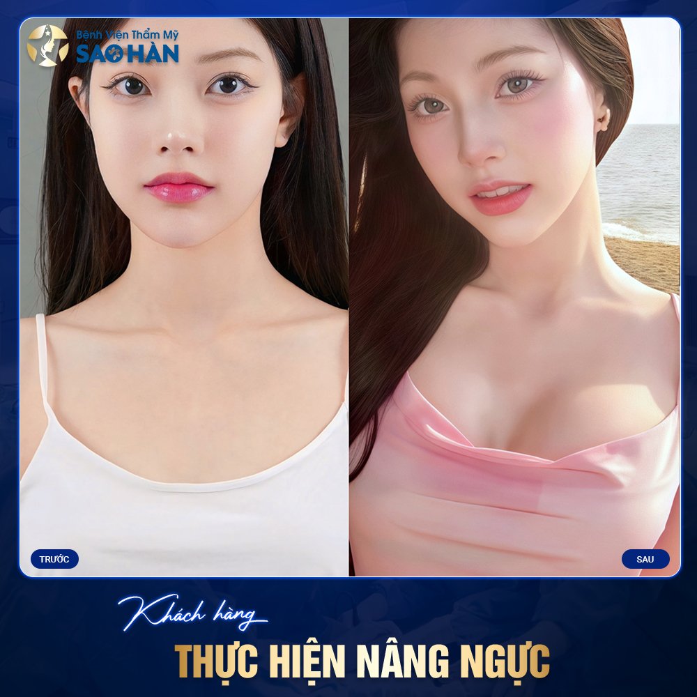 Hình Ảnh Thực Tế Nâng Ngực Tại Bệnh Viện Sao Hàn