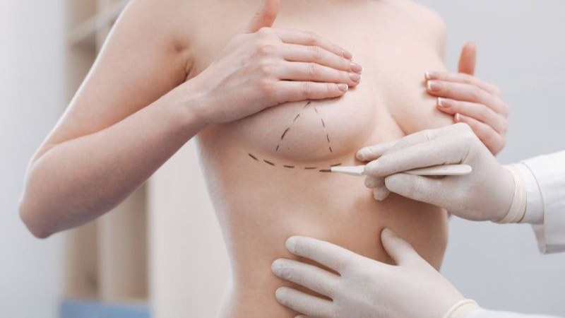 Tìm Đến Bác Sĩ Để Được Tư Vấn Về Phương Pháp Nâng Ngực Phù Hợp