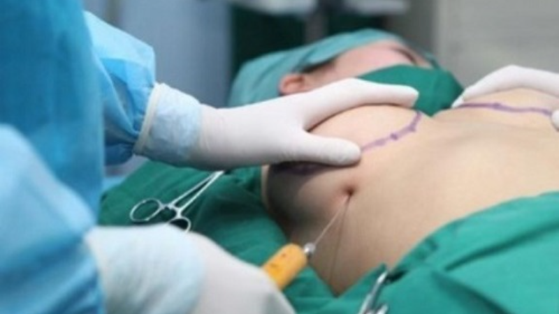 Quy Trình Thực Tế Sẽ Được Bác Sĩ Quyết Định Với Từng Tình Trạng Khách Hàng Khi Đến Thăm Khám.
