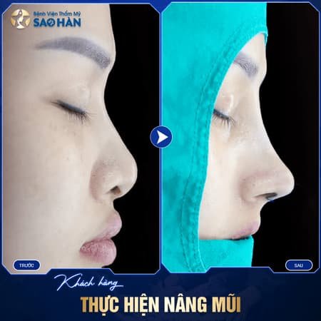 Nang Mui Cau Truc 4D Sao Han 5