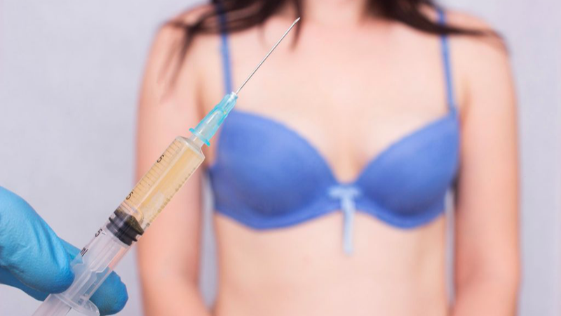 Nâng Ngực Bằng Phương Pháp Tiêm Filler